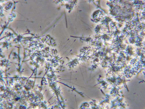 Hyphomicrobium under the Microscope