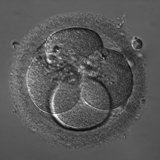 iHMC miroscope image of an embryo.