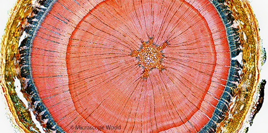 Woody Stem Cross Section Image Stitching under Microscope