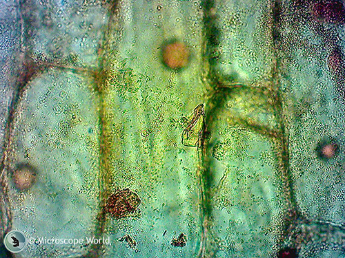 Microscopy image of iodine onion captured under the microscope at 400x.