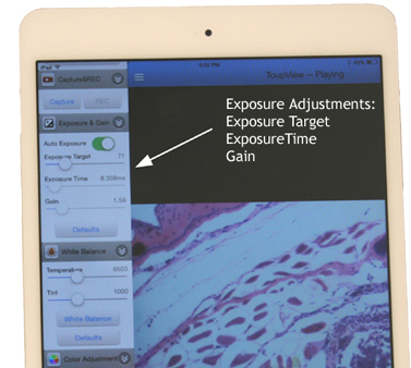 WiFi microscope camera exposure feature image