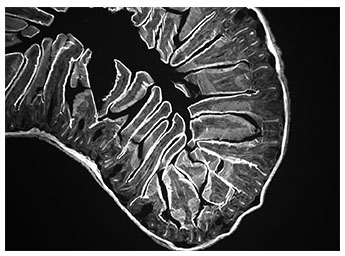 Mouse intestine image captured with monochrome microscopy camera.