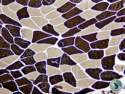 Muscle captured under a brightfield microscope.