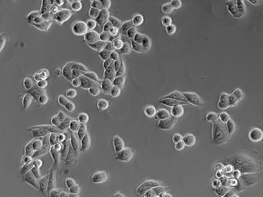 HeLa Cells Captured under Zeiss Primovert Phase Inverted Microscope