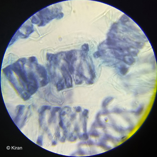 Spirogyra Algae Under the Microscope 100x