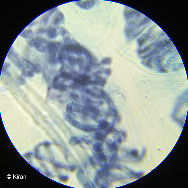 Spirogyra Algae Under the Microscope 100x