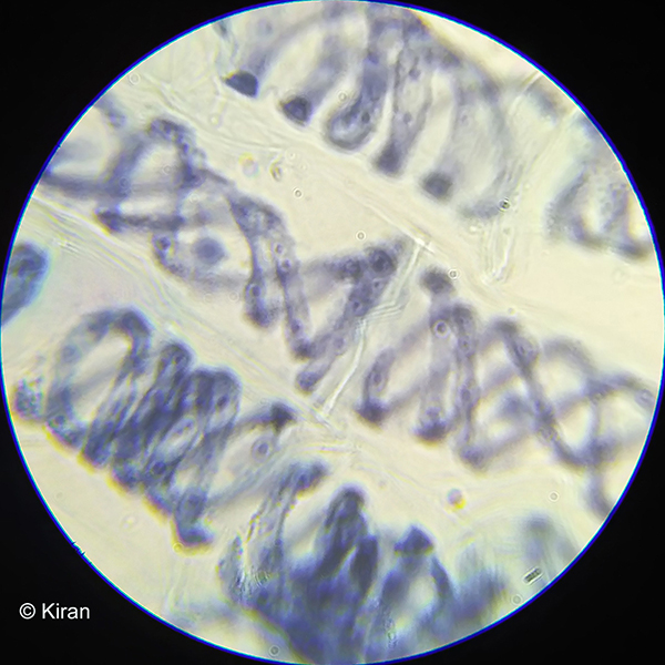 Spirogyra under the Microscope