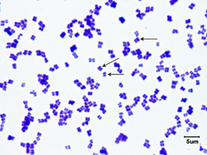 Tetrad under brightfield microscope