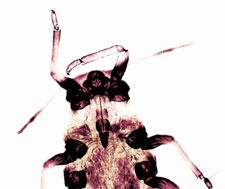 Microscope image of aphid