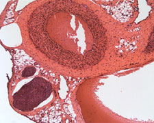 Arteries Image