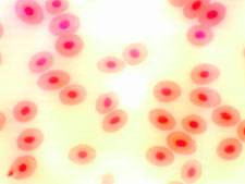Microscope image, frog's blood, 1000x