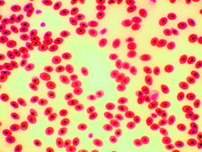 Microscope image of frog's blood, 400x