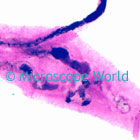 schistosoma microscope image