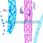 spirogyra microscope image