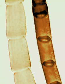 Microscope image, insect antenna 100x