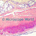 Esophagus Microscope Image