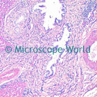 Liver Tissue Microscope Image