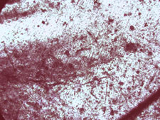 Microscope image, penny 100x