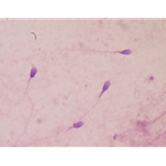 Andrology Semen Analysis Microscopes