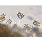 Wastewater Treatment Organism Identification