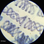 Spirogyra Under the Microscope