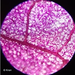 Bougainvillea Under the Microscope