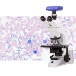 Choosing a Hematology Microscope
