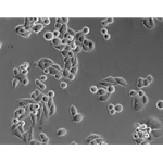 What is a Phase Contrast Microscope Used For?