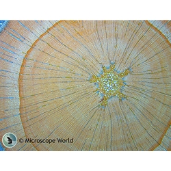 Woody Stem Under the Microscope