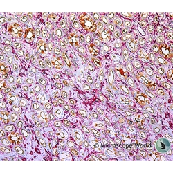 Dog Kidney Disease Under the Microscope
