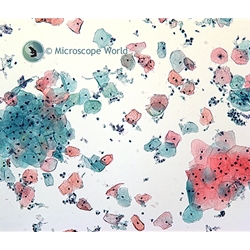 Pap Smear under the Microscope