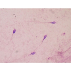 Andrology Semen Analysis Microscopes