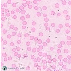 Microscope Resolution Explained Using Blood Cells