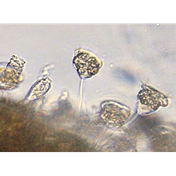 Wastewater Treatment Organism Identification