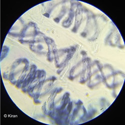 Spirogyra Under the Microscope