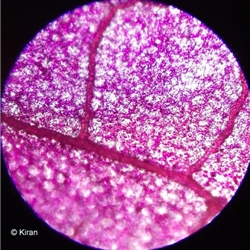 Bougainvillea Under the Microscope