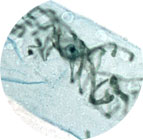 Spirogyra