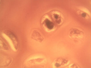 Trachae under the microscope, 1000x