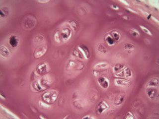 Trachea under the microscope, 400x