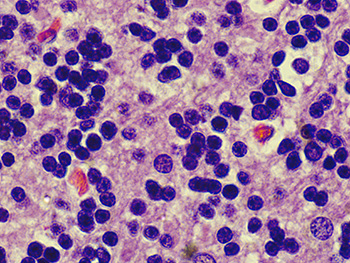 100x zeiss primostar lens ovary 100x zeiss primostar lens ovary