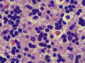 100x motic panthera lens ovary 100x motic panthera lens ovary