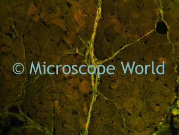 Layered Larynx Image