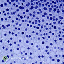 Onion Root Tips under the Microscope