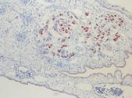 Pathology Image
