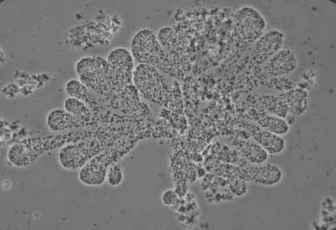 Zooglea under the microscope Zooglea under the Microscope