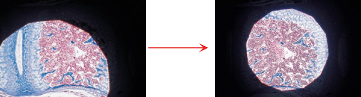 Properly Centered Microscope Condenser Properly Centered Microscope Condenser