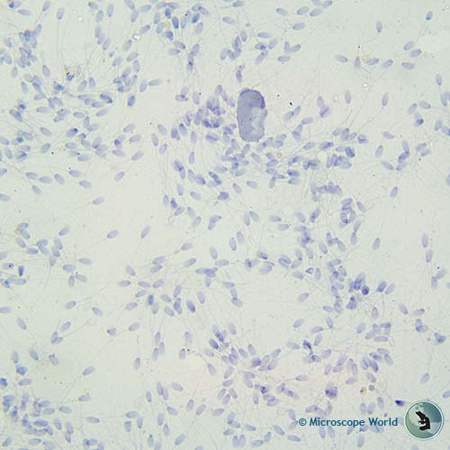 human sperm 100x magnification human sperm 100x magnification