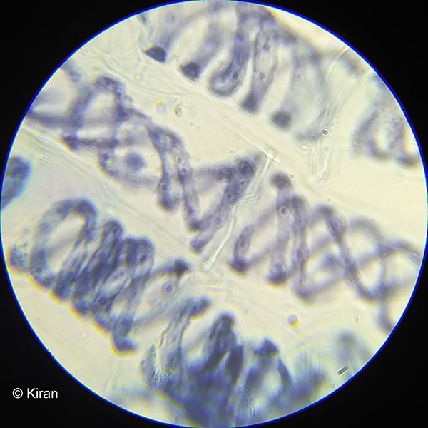 Spirogyra under the Microscope Spirogyra under the Microscope
