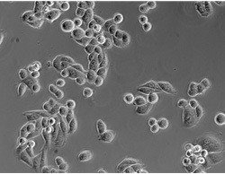 Phase contrast microscopy  Phase contrast microscopy